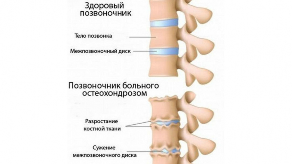 болит шея сзади / почему болит шея сзади